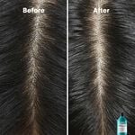 L'Oréal Professionnel Serie Expert Scalp Advanced Anti-Dandruff Dermo Clarifier Shampoo 300ml