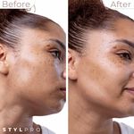 StylPro 2-in-1 Sonic Dermaplane