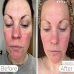 StylPro Wavelength LED Face Mask