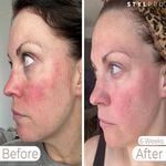 StylPro Wavelength LED Face Mask